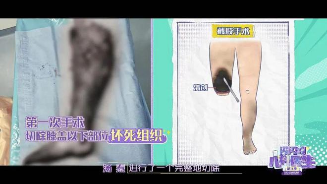 小概率”奇迹以医者仁心守护生命微光不朽情缘版《闪闪的儿科医生》书写“(图2)